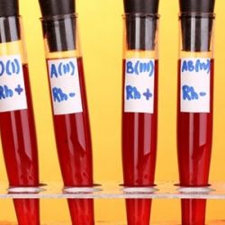 ФИНАНСОВЫЕ ВАМПИРЫ: Гомельчане-доноры ради большей компенсации занимались махинациями